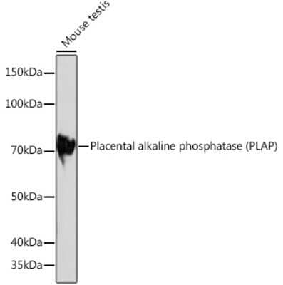 Western Blot: Alkaline Phosphatase/ALPP/ALPI Antibody (10Q2X7) [NBP3-16373]