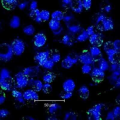 Immunocytochemistry/ Immunofluorescence: Alkaline Phosphatase/ALPP Antibody (8B6) - Azide and BSA Free [NBP2-80568]