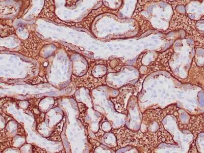 Immunohistochemistry-Paraffin: Alkaline Phosphatase/ALPP Antibody (ALP/870) - Azide and BSA Free [NBP2-47988]