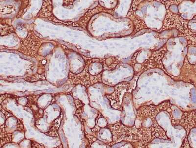 Immunohistochemistry-Paraffin: Alkaline Phosphatase/ALPP Antibody (ALP/870) [NBP2-44954]