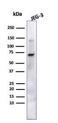 Western Blot: Alkaline Phosphatase/ALPP Antibody (ALP/870) [NBP2-44954]