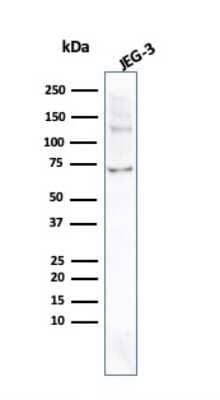 Western Blot: Alkaline Phosphatase/ALPP Antibody (ALPP/2899R)Azide and BSA Free [NBP3-08817]