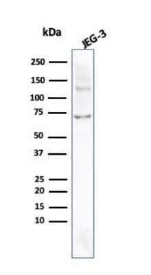 Western Blot: Alkaline Phosphatase/ALPP Antibody (ALPP/2899R) [NBP3-07800]