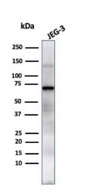 Western Blot: Alkaline Phosphatase/ALPP Antibody (GM022) [NBP2-44958]