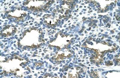 Immunohistochemistry-Paraffin: Alkaline Phosphatase/ALPP Antibody [NBP1-57907]