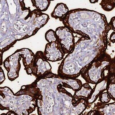 Immunohistochemistry-Paraffin: Alkaline Phosphatase/ALPP Antibody [NBP2-34056]