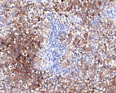 Immunohistochemistry-Paraffin: Alkaline Phosphatase/ALPP Antibody (JM22-53) [NBP2-67136]
