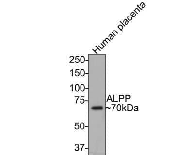 Western Blot: Alkaline Phosphatase/ALPP Antibody (JM22-53) [NBP2-67136]