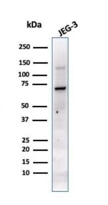 Western Blot: Alkaline Phosphatase/ALPP Antibody (PL8-F6)Azide and BSA Free [NBP2-47993]