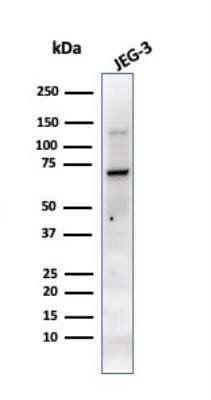 Western Blot: Alkaline Phosphatase/ALPP Antibody (PL8-F6) [NBP2-44959]