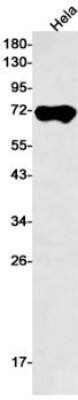 Western Blot: Alkaline Phosphatase/ALPP Antibody (S01-8I3) [NBP3-20050]