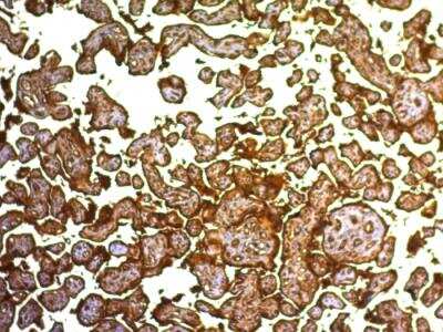 Immunohistochemistry-Paraffin: Alkaline Phosphatase/ALPP Antibody (SPM593) - Azide and BSA Free [NBP2-47989]