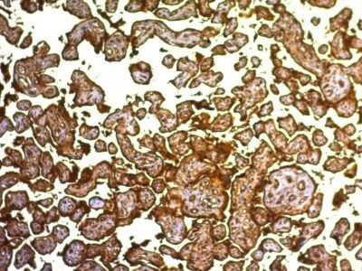 Immunohistochemistry-Paraffin: Alkaline Phosphatase/ALPP Antibody (SPM593) - IHC-Prediluted [NBP2-48099]