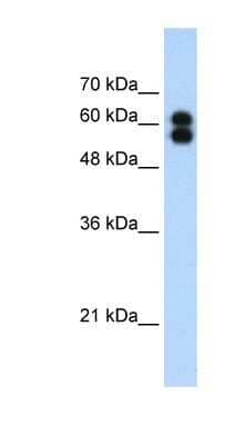 Western Blot: Alkaline Phosphatase/ALPP Antibody [NBP1-57907]