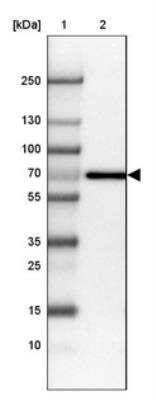 Western Blot: Alkaline Phosphatase/ALPP Antibody [NBP2-34056]