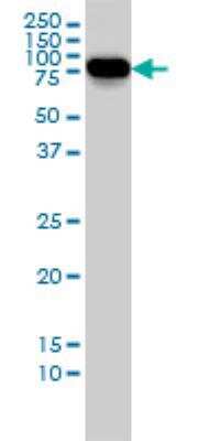 Western Blot: Alkaline Phosphatase, Tissue Non-Specific Antibody (4H1) [H00000249-M01]