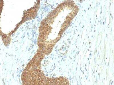 Immunohistochemistry-Paraffin: Alkaline Phosphatase, Tissue Non-Specific Antibody (ALPL/597) - Azide and BSA Free [NBP2-54376]