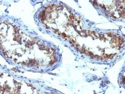 Immunohistochemistry-Paraffin: Alkaline Phosphatase, Tissue Non-Specific Antibody (ALPL/597) - Azide and BSA Free [NBP2-54376]
