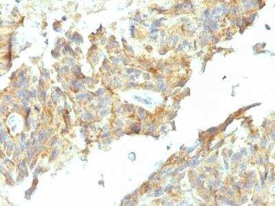 Immunohistochemistry-Paraffin: Alkaline Phosphatase, Tissue Non-Specific Antibody (ALPL/597) - Azide and BSA Free [NBP2-54376]