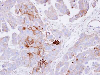 Immunohistochemistry-Paraffin: Alkaline Phosphatase, Tissue Non-Specific Antibody [NBP1-32948]