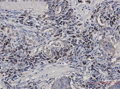 Immunohistochemistry-Paraffin: Alkaline Phosphatase, Tissue Non-Specific Antibody (S08-6H0) [NBP3-19565]