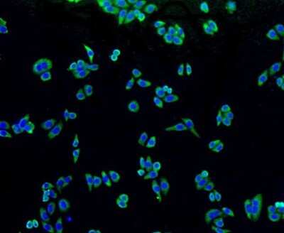 Immunocytochemistry/ Immunofluorescence: Alkaline Phosphatase, Tissue Non-Specific Antibody (SA40-00) [NBP2-67295]