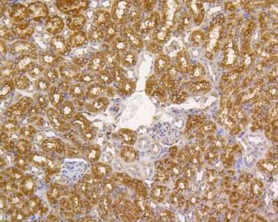 Immunohistochemistry-Paraffin: Alkaline Phosphatase, Tissue Non-Specific Antibody (SA40-00) [NBP2-67295]