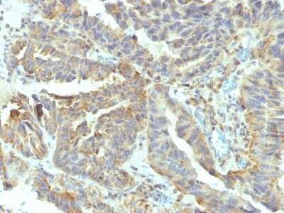 Immunohistochemistry-Paraffin: Alkaline Phosphatase, Tissue Non-Specific Antibody (V17.1) - Azide and BSA Free [NBP2-47996]