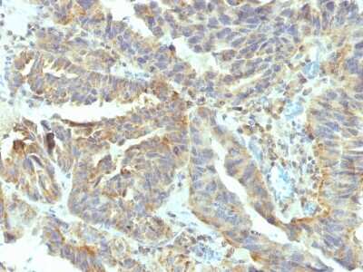 Immunohistochemistry-Paraffin: Alkaline Phosphatase, Tissue Non-Specific Antibody (V17.1) [NBP2-44962]