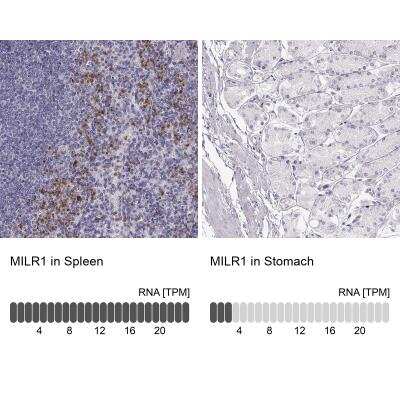Immunohistochemistry-Paraffin: Allergin-1 Antibody [NBP2-76516]