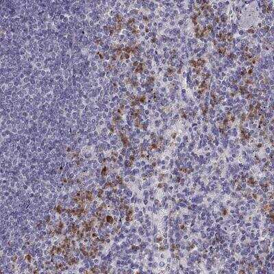 Immunohistochemistry-Paraffin: Allergin-1 Antibody [NBP2-76516]