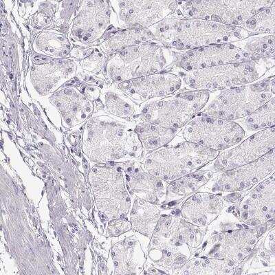 Immunohistochemistry-Paraffin: Allergin-1 Antibody [NBP2-76516]