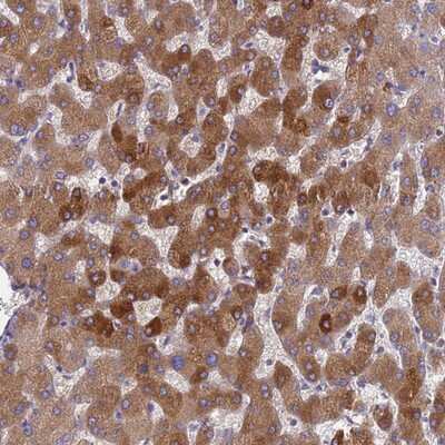 Immunohistochemistry-Paraffin: alpha 1-Acid Glycoprotein Antibody [NBP2-13717]