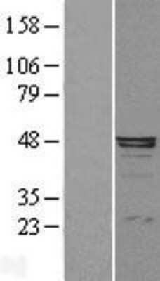 Western Blot: alpha 1-Microglobulin Overexpression Lysate [NBL1-07495]