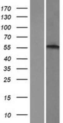 Western Blot: alpha-1B Adrenergic R/ADRA1B Overexpression Lysate [NBP2-10695]