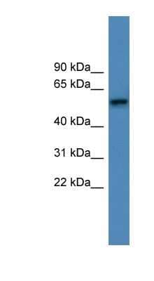 Western Blot: alpha-1D Adrenergic R/ADRA1D Antibody [NBP1-68951]