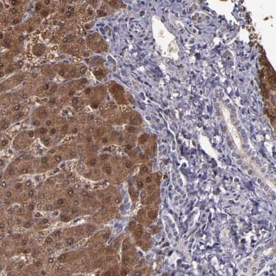 Immunohistochemistry-Paraffin: Serpin F2/alpha 2-Antiplasmin Antibody [NBP1-90305]