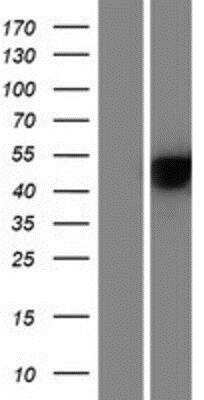 Western Blot: Serpin F2/alpha 2-Antiplasmin Overexpression Lysate [NBP2-10146]