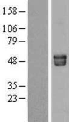 Western Blot: Fetuin A/AHSG Overexpression Lysate [NBL1-07405]