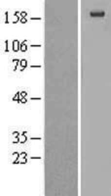 Western Blot: alpha 2-Macroglobulin Overexpression Lysate [NBL1-07157]