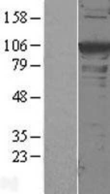 Western Blot: alpha-Actinin 1 Overexpression Lysate [NBL1-07282]