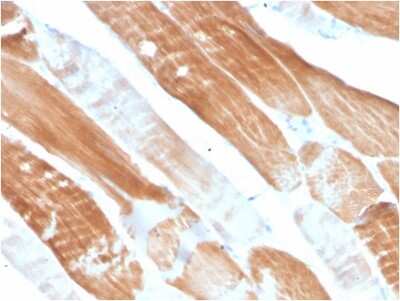 Immunohistochemistry-Paraffin: Alpha Actinin 2 Antibody (ACTN2/3291) [NBP3-07465]