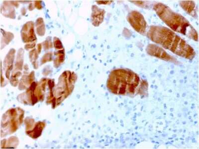 Immunohistochemistry-Paraffin: Alpha Actinin 2 Antibody (ACTN2/3291) - Azide and BSA Free [NBP3-08584]