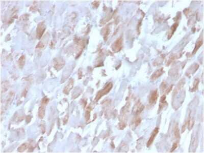 Immunohistochemistry-Paraffin: Alpha Actinin 2 Antibody (ACTN2/3291) - Azide and BSA Free [NBP3-08584]