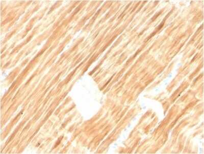 Immunohistochemistry-Paraffin: Alpha Actinin 2 Antibody (ACTN2/3292) - Azide and BSA Free [NBP2-79838]