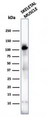 Western Blot: Alpha Actinin 2 Antibody (ACTN2/3292)Azide and BSA Free [NBP2-79838]