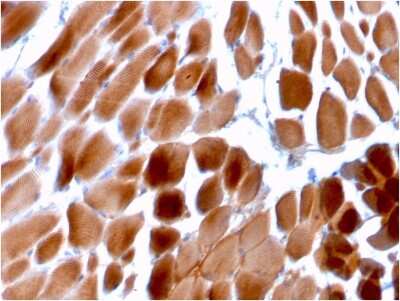 Immunohistochemistry-Paraffin: Alpha Actinin 2 Antibody (ACTN2/3292) [NBP2-79704]