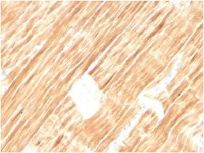 Immunohistochemistry-Paraffin: Alpha Actinin 2 Antibody (ACTN2/3292) [NBP2-79704]