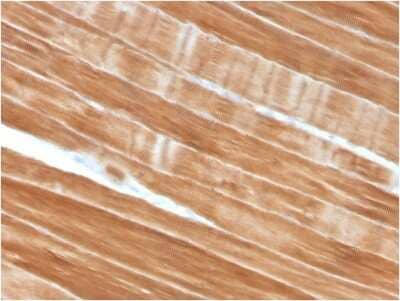 Immunohistochemistry-Paraffin: Alpha Actinin 2 Antibody (ACTN2/3292) [NBP2-79704]