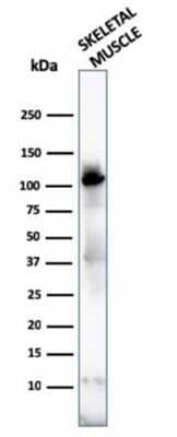 Western Blot: Alpha Actinin 2 Antibody (ACTN2/3292) [NBP2-79704]